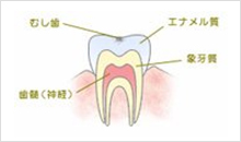 C0（脱灰）